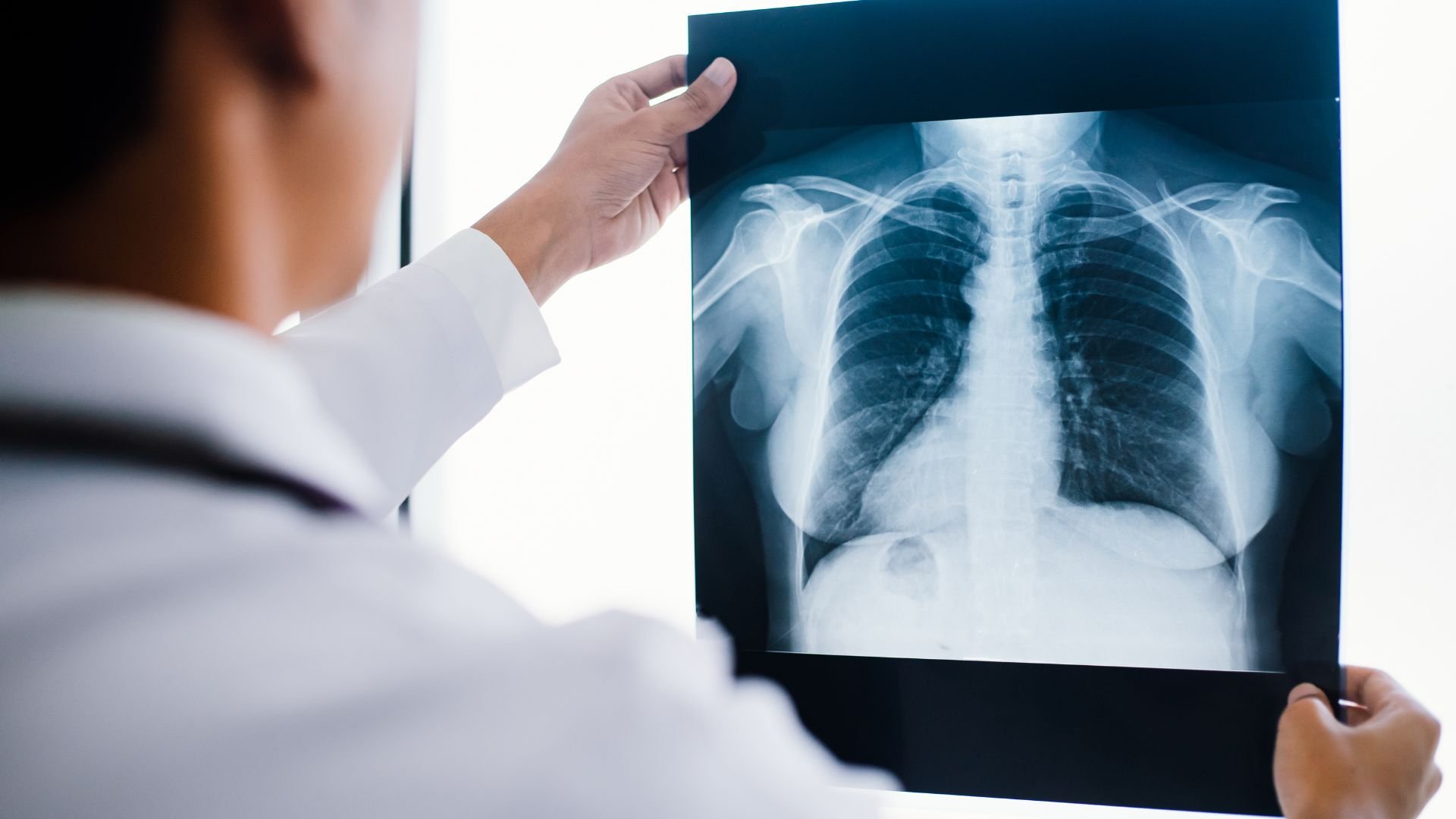 Medical professional examining chest X-ray showing human ribcage and lungs